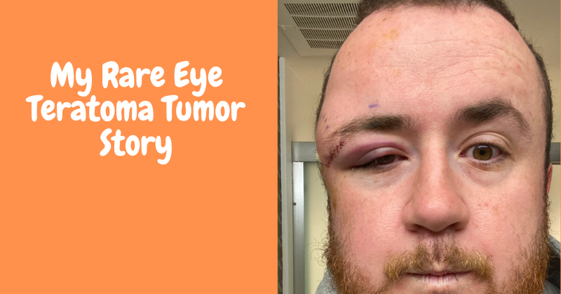 My Rare Eye Teratoma Story logo - This post shares the personal and emotional journey of living with and getting treatment for a ra...